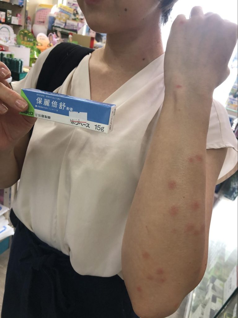 台湾での虫刺されに要注意！ 強烈な痒みに襲われる最恐の虫「小黒蚊」、刺された際の症状と対策